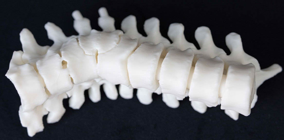 3D printed Spine