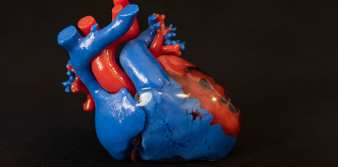 3D printed heart