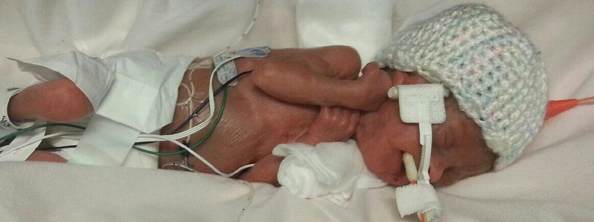 photo-preemiesmicropreemies-main