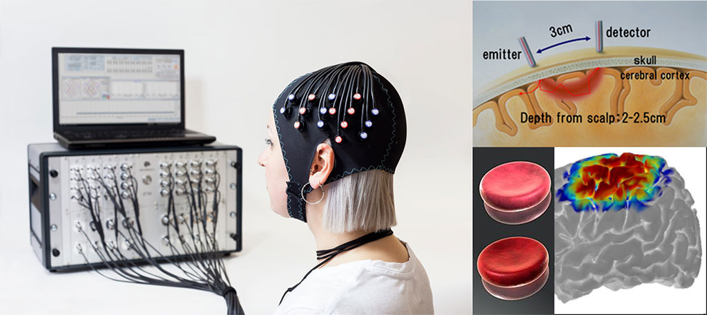 fNIRS-Figure-1---Left