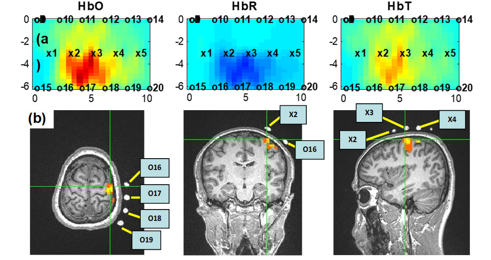 fNIRS-Figure-2---FNIRS