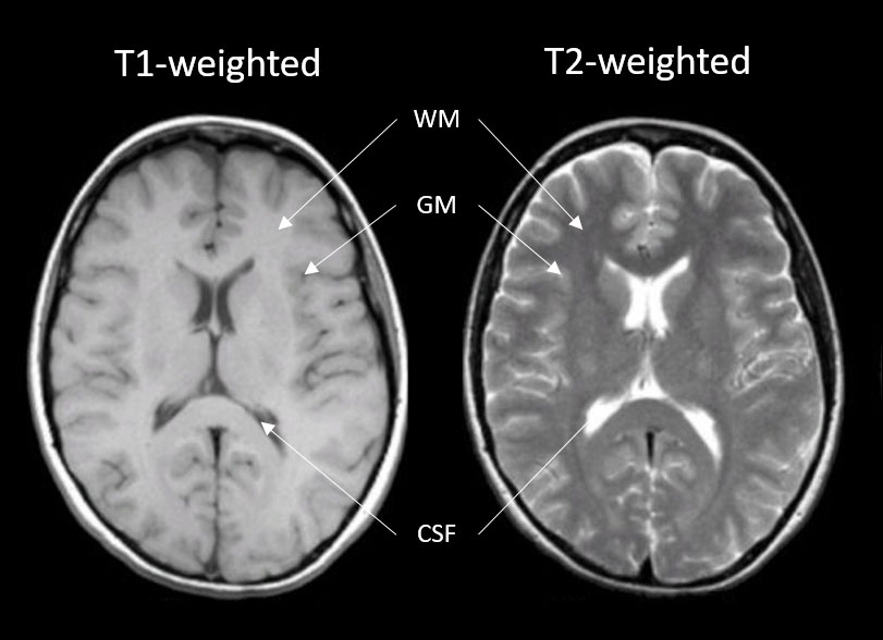 MRI-Figure-2---MRI