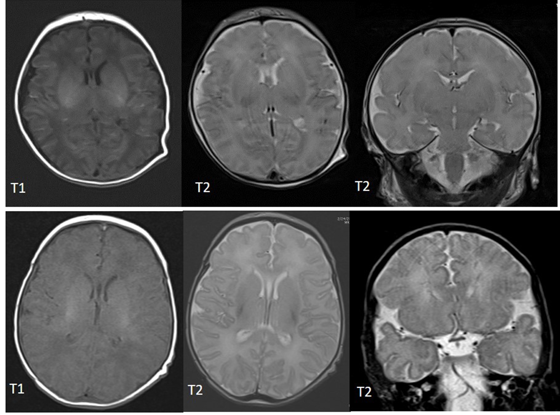 neo-fig-1---neonate_mri-main