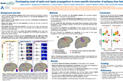 Overlapping onset of spike and ripple propagations is more specific biomarker of epilepsy than fast ripples