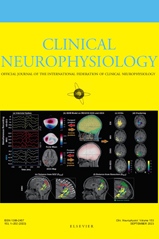 Electromagnetic source imaging predicts surgical outcome in children with focal cortical dysplasia