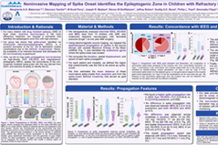 Noninvasive mapping of spike onset identifies the epileptogenic zone in children with refractory epilepsy