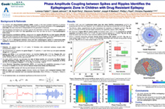 Phase amplitude coupling between spikes and ripples identified the epileptogenic zone in children with drug resistant epilepsy
