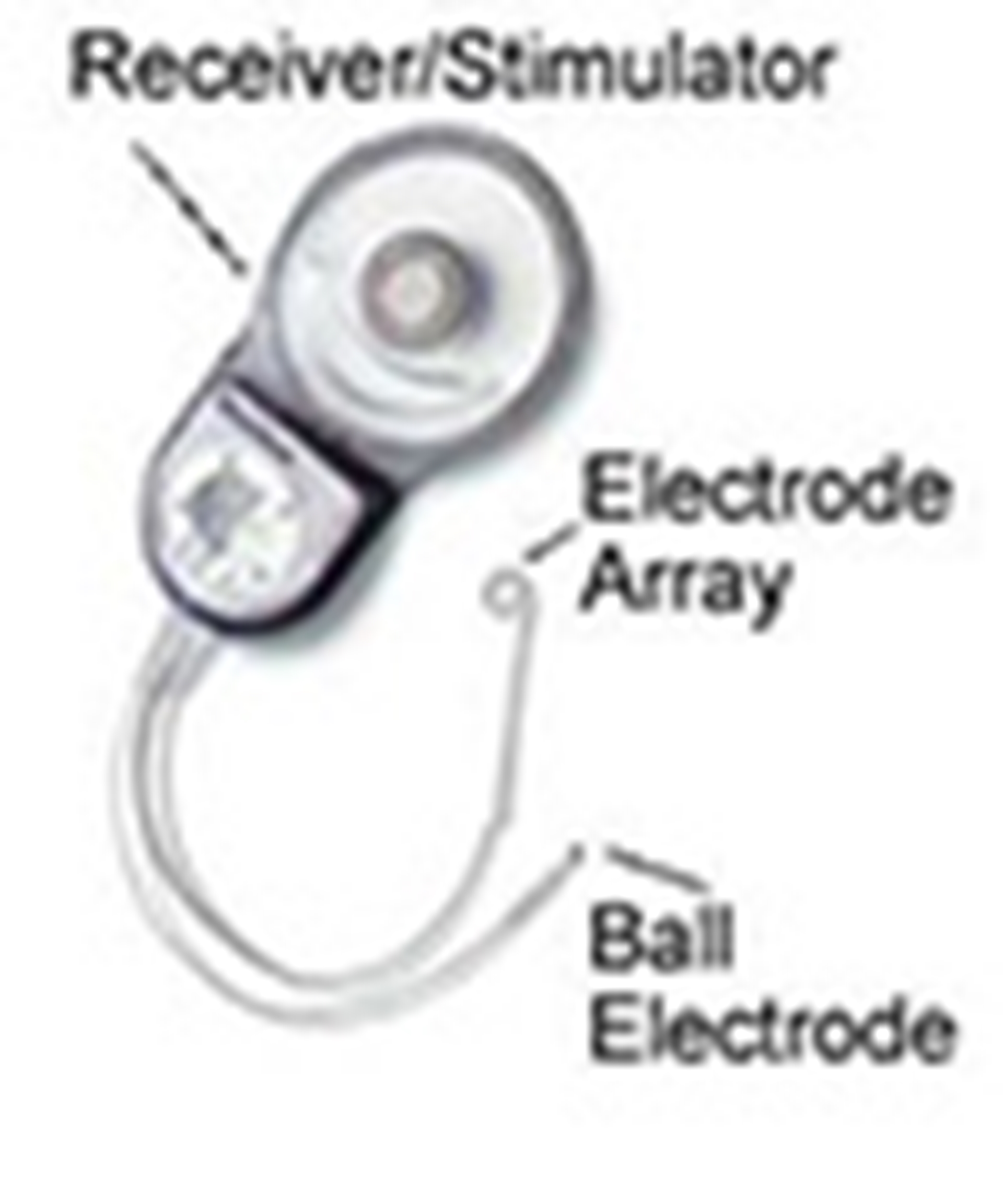 photo-cochleardevice-main